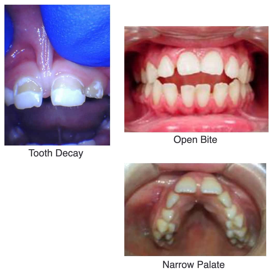Other Correlated Issues
