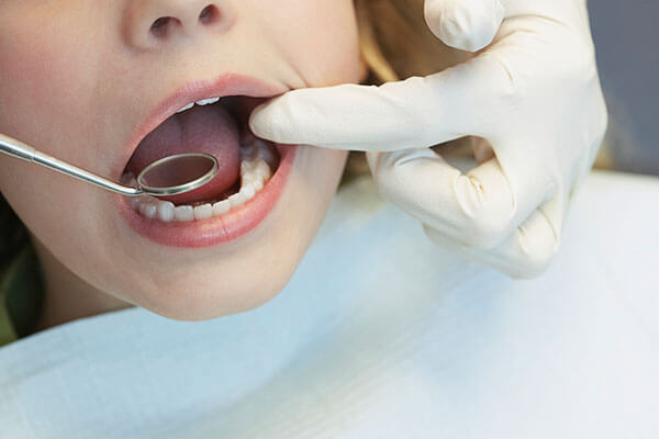 Closeup of child's mouth with dental mirror